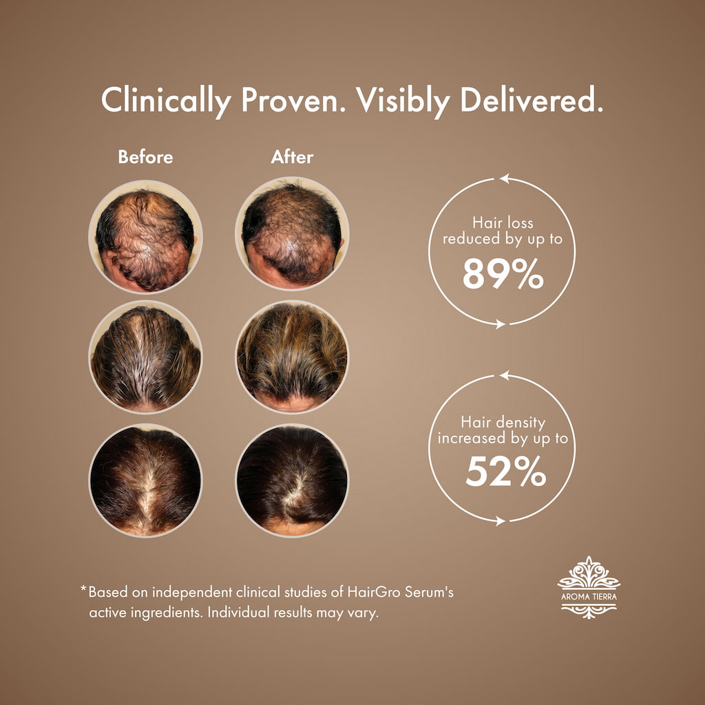 HairGro Hair Growth Serum for Women (with 9 Clinically Proven Bio-Actives)