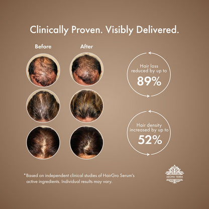 HairGro Hair Growth Serum for Women (with 9 Clinically Proven Bio-Actives)